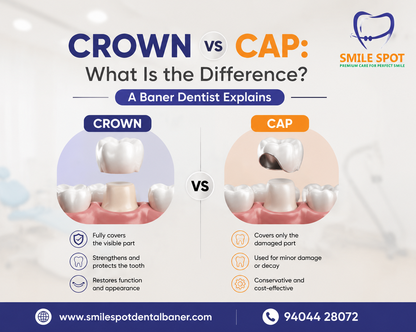 Crown vs Cap: What Is the Difference? A Baner Dentist Explains