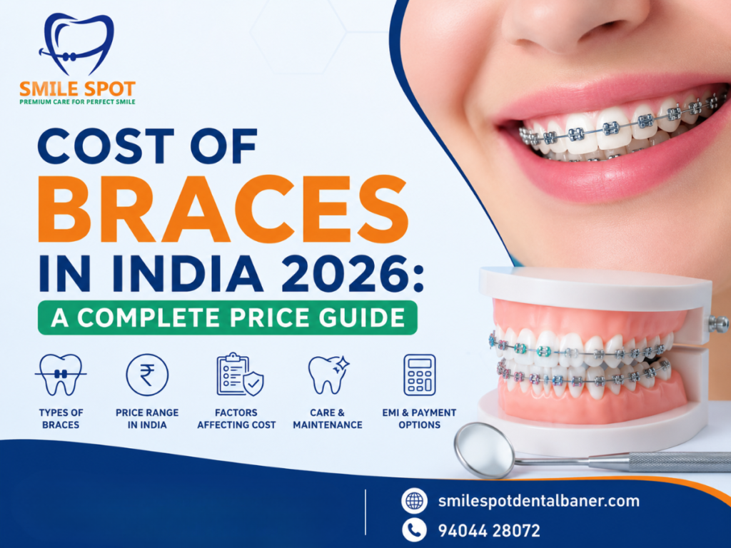 Cost of Braces in India 2026