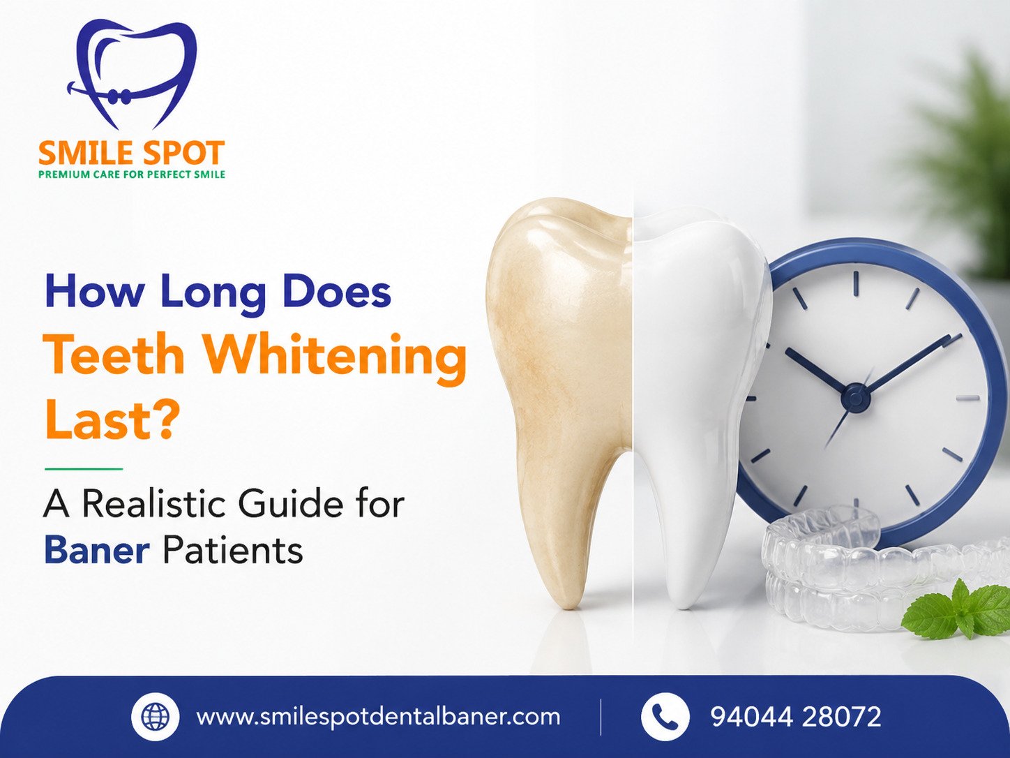 How Long Does Teeth Whitening Last? A Realistic Guide for Baner Patients