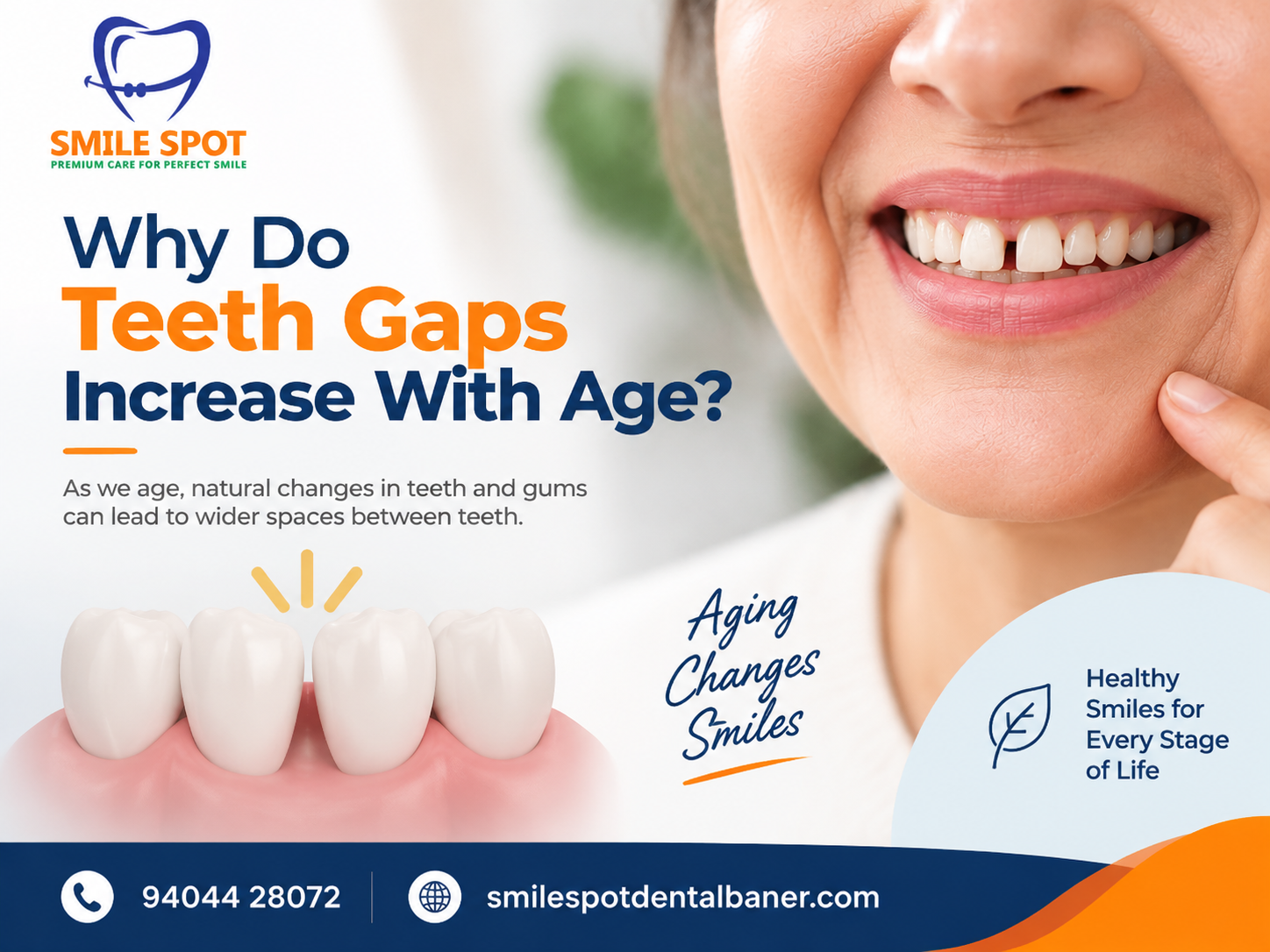 Why Do Teeth Gaps Increase With Age?